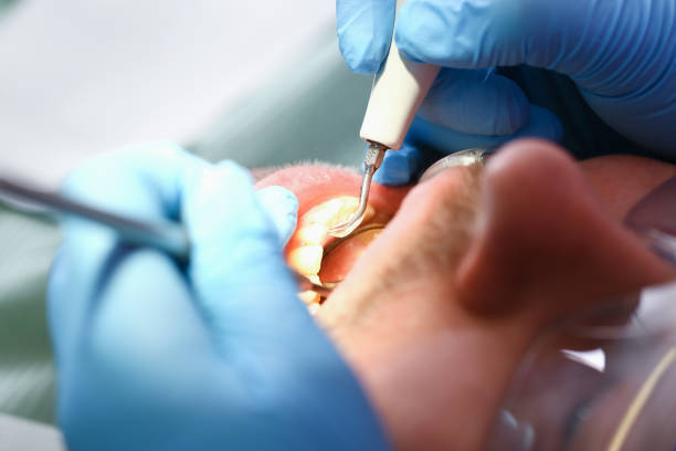 Best Weekend Emergency Dental Services in Wona Lake, IN